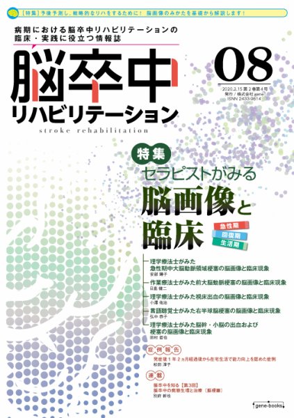 脳卒中リハビリテーション 第2巻・第4号 (発売日2020年02月15日) 表紙
