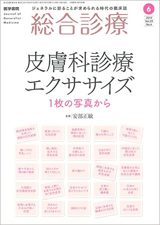 総合診療 Vol.29 No.6 (発売日2019年06月15日) 表紙
