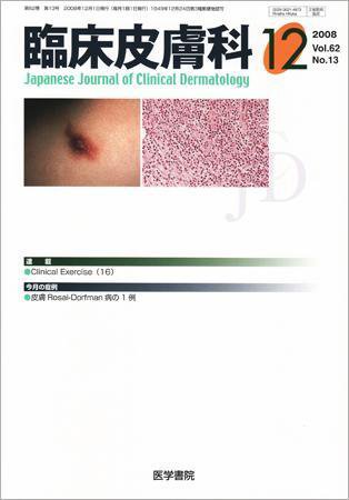 臨床皮膚科 62巻13号 (発売日2008年12月01日) 表紙