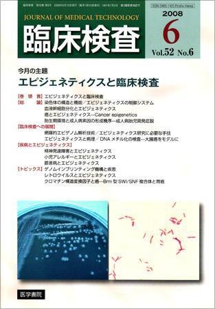 臨床検査 52巻6号 (発売日2008年06月15日) 表紙