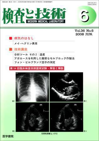 検査と技術 Vol.36 No.6 (発売日2008年06月01日) 表紙