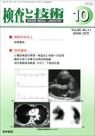 検査と技術 Vol.36 No.11 (発売日2008年10月01日) 表紙