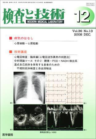 検査と技術 Vol.36 No.13 (発売日2008年12月01日) 表紙