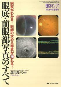 眼科ケア 冬季増刊 (発売日2008年12月31日) 表紙