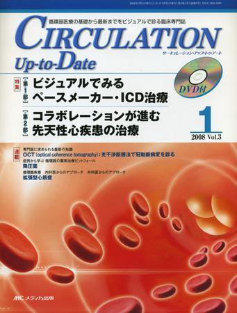 CIRCULATION Up-to-Date（サーキュレーション・アップ・トゥ・デート） 2008年1号 (発売日2008年03月18日) 表紙