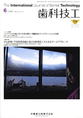 歯科技工 36巻6号 (発売日2008年05月31日) 表紙