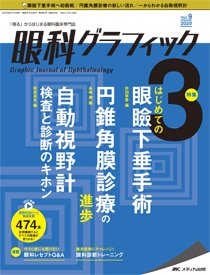 眼科グラフィック 2020年3号 (発売日2020年05月15日) 表紙