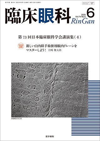 臨床眼科 Vol.74 No.6 (発売日2020年06月15日) 表紙
