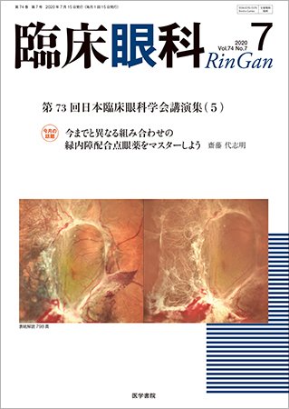 臨床眼科 Vol.74 No.7 (発売日2020年07月15日) 表紙