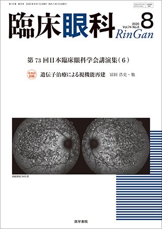 臨床眼科 Vol.74 No.8 (発売日2020年08月15日) 表紙