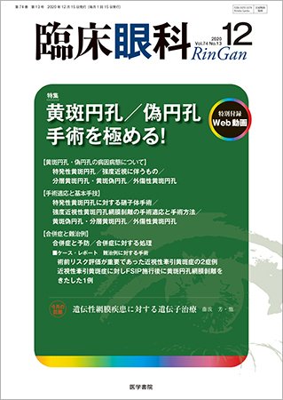 臨床眼科 Vol.74 No.13 (発売日2020年12月15日) 表紙