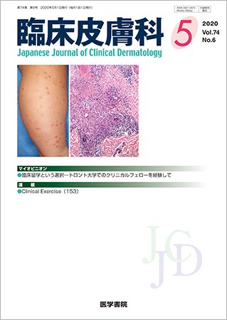 臨床皮膚科 Vol.74 No.6 (発売日2020年05月25日) 表紙