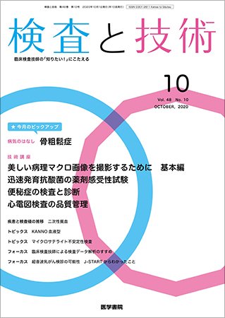 検査と技術 Vol.48 No.10 (発売日2020年10月01日) 表紙