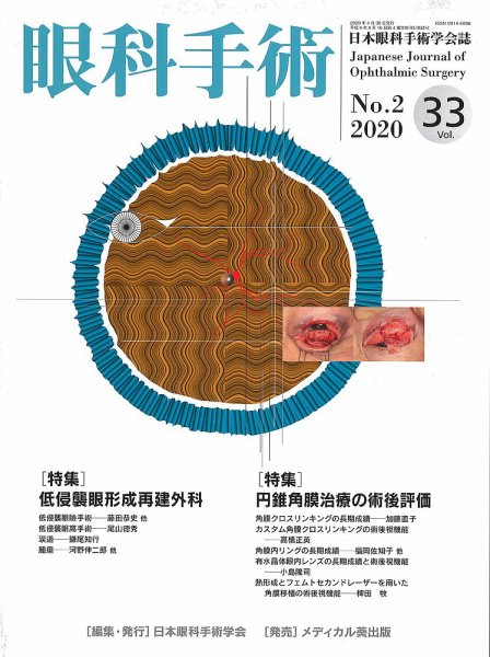 眼科手術 Vol.33 No.2 (発売日2020年04月30日) 表紙