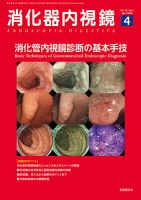 消化器内視鏡 20年4月号 (発売日2020年04月25日) 表紙