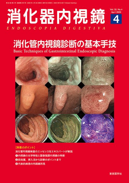 消化器内視鏡 20年4月号 (発売日2020年04月25日) 表紙