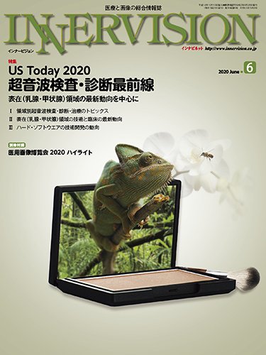 INNERVISION（インナービジョン） 2020年6月号 (発売日2020年06月01日) 表紙
