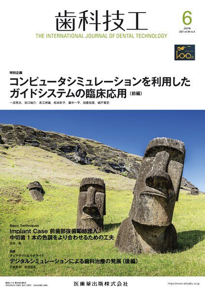歯科技工 Vol.49 No.6 (発売日2021年05月25日) 表紙