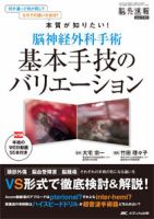 脳神経外科専門医をめざすための経験すべき手術 44 脳神経外科専門医をめざすための経験すべき手術44 | 河瀬 斌 |本