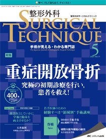 整形外科サージカルテクニックの最新号 21年5号 発売日21年09月15日 雑誌 定期購読の予約はfujisan