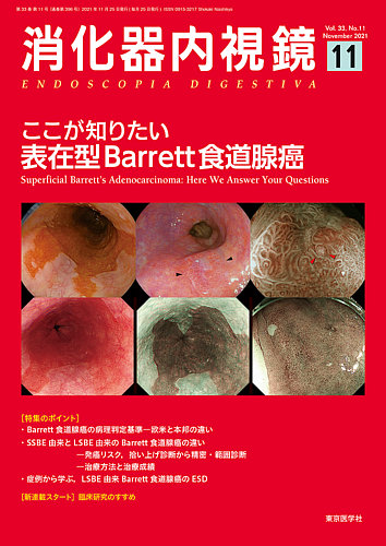 完全鏡視下肺葉切除術/金芳堂/宮本好博（日記） 完全鏡視下肺葉切除術 左上葉切除術 [DVD] | 宮本好博 |本