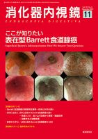 消化器内視鏡 21年11月号 (発売日2021年11月25日) 表紙