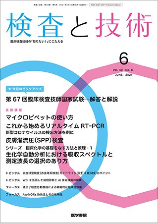 検査と技術 Vol.49 No.6 (発売日2021年06月01日) 表紙