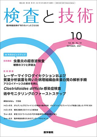 検査と技術 Vol.49 No.10 (発売日2021年10月01日) 表紙
