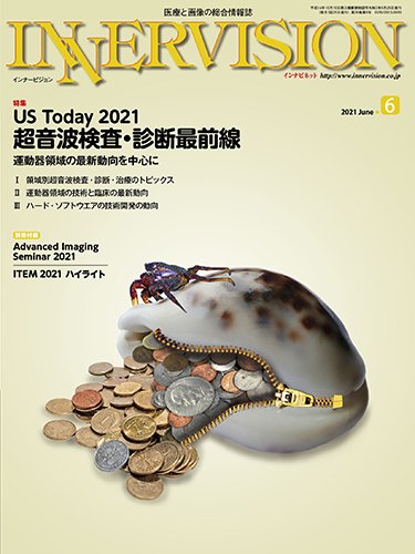 INNERVISION（インナービジョン） 2021年6月号 (発売日2021年06月01日) 表紙