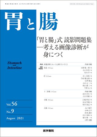 胃と腸 Vol.56 No.9 (発売日2021年08月25日) 表紙