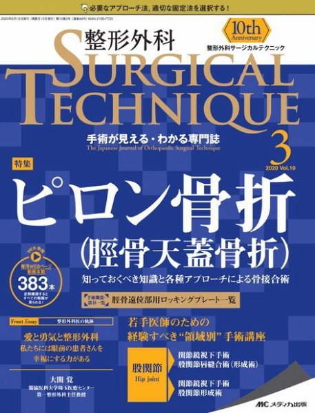 販売売品 未使用本 ○ 骨折の術前計画 ○メディカ出版 【公式通販】