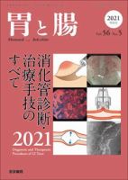 胃と腸 Vol.56 No.5 (発売日2021年05月24日) 表紙