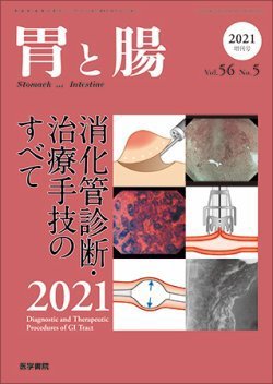 胃と腸 Vol.56 No.5 (発売日2021年05月24日) 表紙