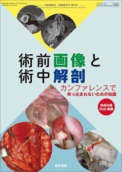耳鼻咽喉科・頭頸部外科 Vol.93 No.5 (発売日2021年04月30日) 表紙