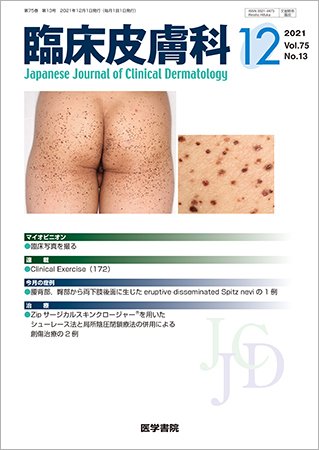 臨床皮膚科 Vol.75 No.13 (発売日2021年12月25日) | 雑誌/定期購読の
