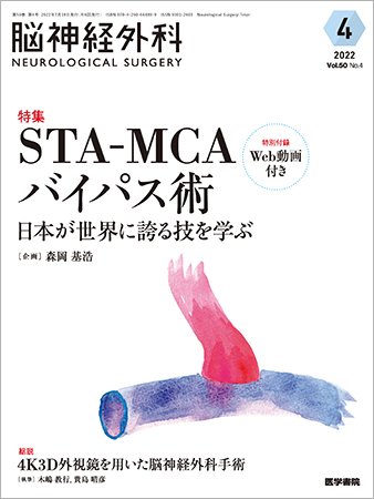 脳神経外科 Vol.50 No.4 (発売日2022年07月10日) | 雑誌/定期購読の