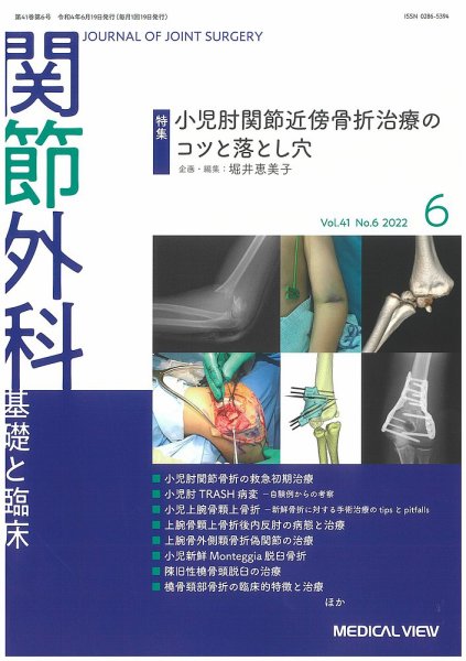 関節外科 2022年6月号 (発売日2022年05月19日) 表紙