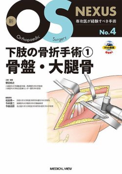 股関節の再建手術［Web動画付］ (新OS NEXUS No.8) | 松田 秀一