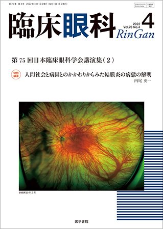 臨床眼科 Vol.76 No.4 (発売日2022年04月15日) 表紙