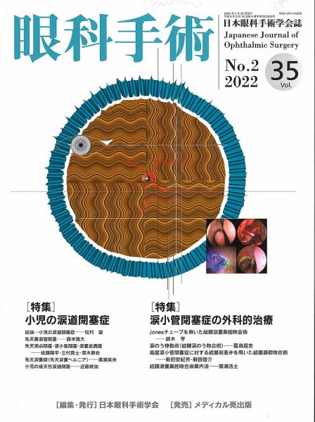眼科手術 Vol.35 No.2 (発売日2022年04月30日) 表紙