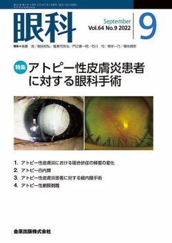 眼科 販売 手術 雑誌