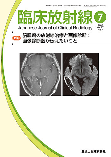 臨床放射線 2022年7月号 (発売日2022年07月20日) | 雑誌/定期購読の