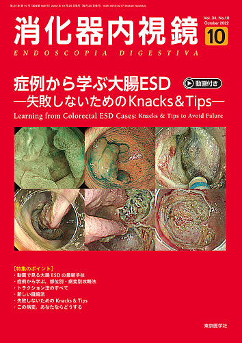 消化器内視鏡 22年10月号 (発売日2022年10月25日) | 雑誌/定期購読の予約はFujisan