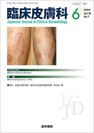 臨床皮膚科 Vol.76 No.7 (発売日2022年06月25日) | 雑誌/定期購読の