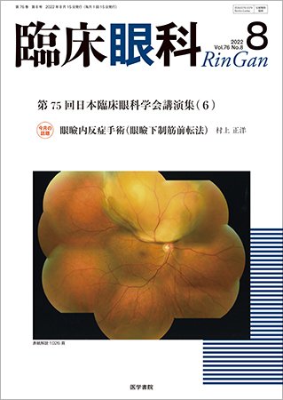 臨床眼科 Vol.76 No.8 (発売日2022年08月15日) 表紙