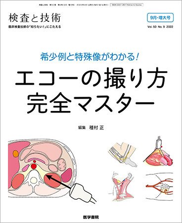 検査と技術 Vol.50 No.9 (発売日2022年09月01日) 表紙