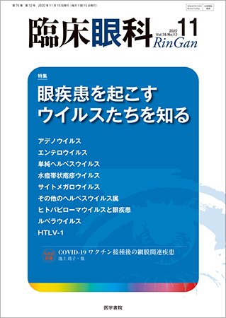臨床眼科 Vol.76 No.12 (発売日2022年11月15日) 表紙