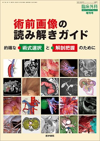 臨床外科 Vol.77 No.11 (発売日2022年10月22日) 表紙