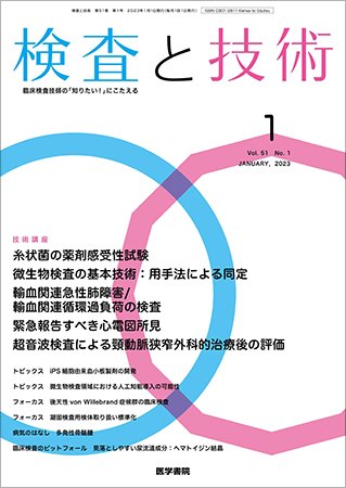 検査と技術 Vol.51 No.1 (発売日2023年01月01日) 表紙