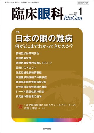 臨床眼科 Vol.77 No.1 (発売日2023年01月15日) 表紙